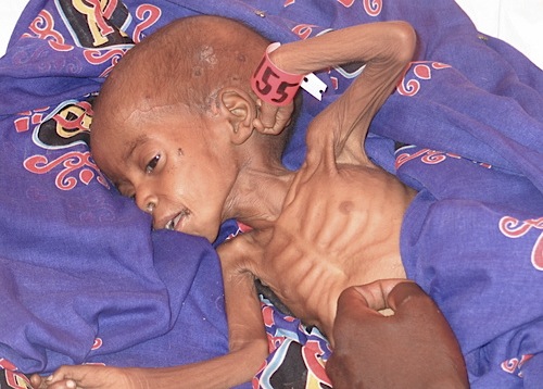 starving-child-darfur