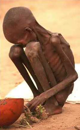 starving_child-sudan2