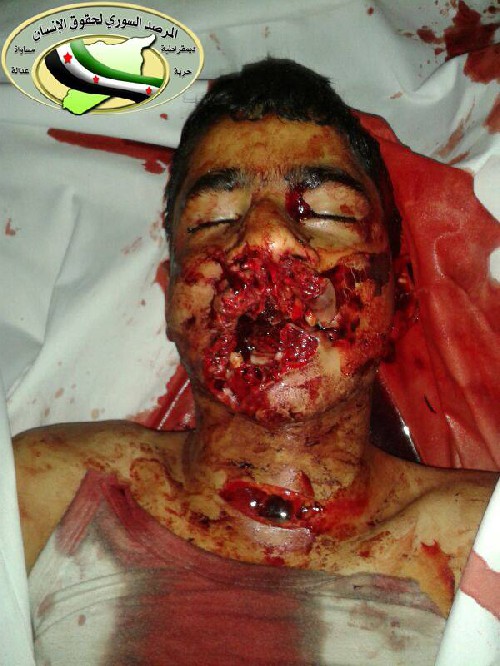 Photo of child executed by islamist rebels in Aleppo 