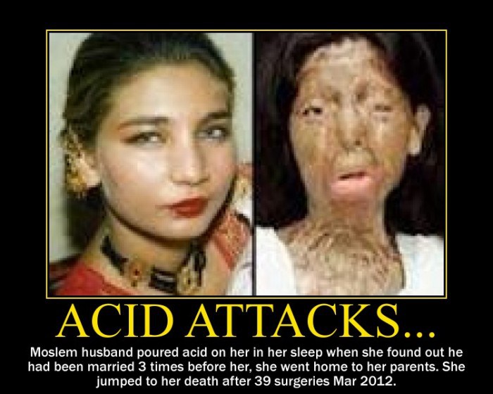 Acid Attacks Under Ipc